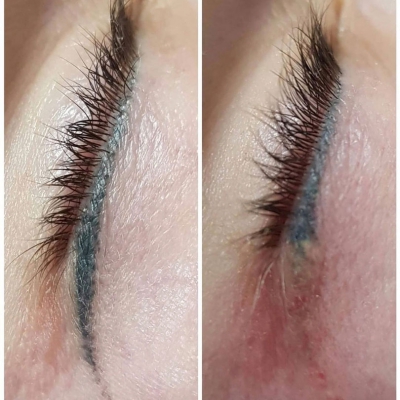 laserowe usuwanie makijażu permanentnego kresek przed i po